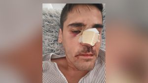 La violencia