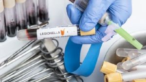 Legionella, già 38 casi a Padova e provincia: l’Usl lancia l’allarme su caldo e impianti a rischio