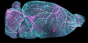 Cerebral small vessel disease: new treatment possibilities for the little‑known condition affecting millions of people