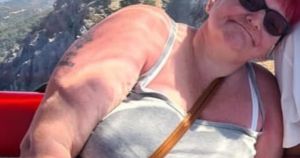 Every day life became a struggle for woman...then she decided to turn her life around