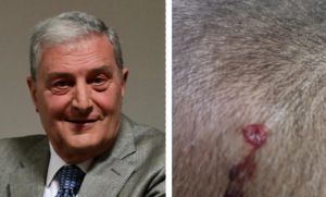 Livorno, spari a una bimba - Per Canaccini l'incubo è finito: «Io estraneo, ma lo sapevano tutti»