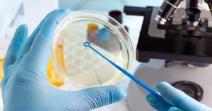 Promising AI cures come with the risk of engineered threats