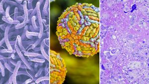 Caldo e malattie: West Nile, colera, ‘febbre della valle’. Il paradosso che può favorire virus, funghi e parassiti