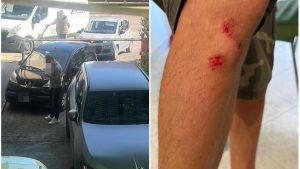Trova il garage ostruito dalle auto e protesta: 