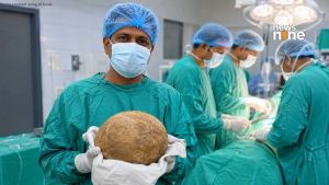 Heavier than a newborn: Doctors remove 3.1kg bladder stone in Sri Lanka