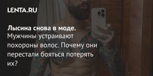 Лысина снова в моде.