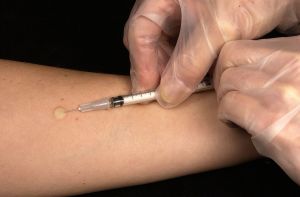 Two Unvaccinated Pennsylvanians Die of Measles, State's First Deaths From Disease in 35 Years Amid US Outbreak