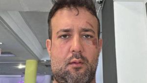 Adriano Stabile, segretatio Pd di Mantova: “Il drone mi è esploso davanti. Non abbandoniamo Kiev”
