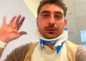 Corporeno, due ragazzi aggrediti dal branco: «Abbiamo pensato di morire»