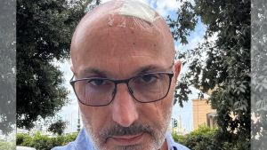 Bastone cade dal terzo piano di un palazzo e lo colpisce alla testa: ferito il giornalista Fabio Carini