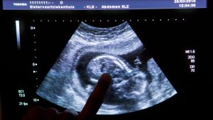 Inspectie tikt Thuisabortus.nl op de vingers. ‘Standaardgesprek nodig tussen vrouw en arts’