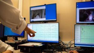 Vall d'Hebron y Bellvitge ensayarán un 'código crisis' para tratar los casos urgentes de epilepsia en solo dos horas