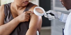AI skin cancer detection tools are getting better – but only for people with light skin