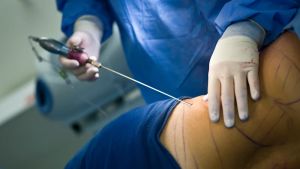 Health watchdog must put patient welfare first and foremost