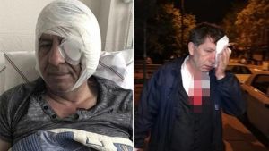 Gazeteciye Saldırı Davası
