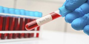 CDC vs. Pennsylvania: Why conflicting public health messages jeopardize public safety