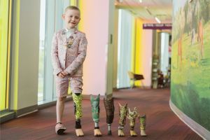 His parents weren’t sure he’d be able to run. Now, he can’t stand still.