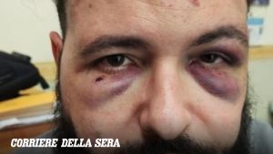 Fotografo pestato a Napoli: «Tarallo mi ha insultato e così scoppio la rissa. Non gli è stato portato via nessun giubbotto»