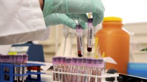 Contagiato da trasfusione di sangue infetto