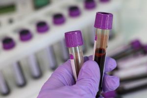 Fiji Declares Formal National HIV Emergency as Infections Surge 12-Fold Over the Past 15 Years, UN Warns