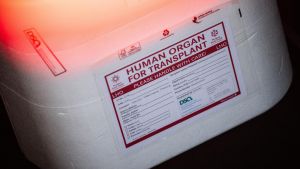 Widerspruchslösung für Organspende: Wir müssen über den Tod sprechen
