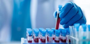 High levels of ‘forever chemicals’ found in Lancashire residents’ blood – what I’ve learned from studying exposed communities for over a decade