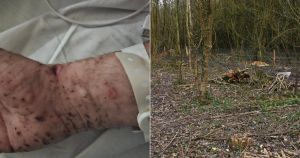 Man's 42-hour blackout which left him with bizarre injuries will remain a mystery