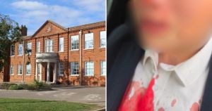 Schoolboy undergoes surgery after assault by another pupil left him seriously injured