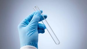 Russia: Nearly 200 under observation in Siberia after lab worker dies from plague in Siberia