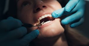 Denti, cosa rischia chi trascura l’igiene orael (anche mal di cuore)