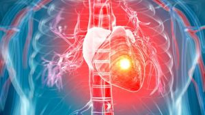 Heart attack, cardiac arrest and heart failure: Understanding 3 conditions often confused