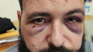 Il fotografo Roberto Tarallo picchiato al Vomero per una spilla antifascista, in aula al processo ricostruita la sera dell'aggressione