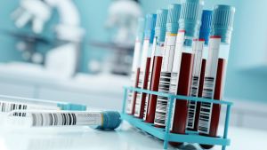 NIPT: Ob sich Eltern für einen Test entscheiden, darf nicht vom Geldbeutel abhängen