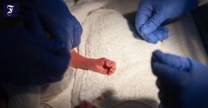 Belastung für Kassen und Kliniken