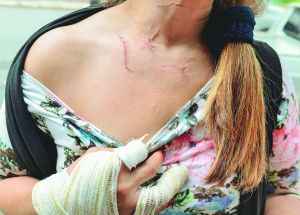 Não basta punir o feminicídio: é preciso impedir que ele aconteça
